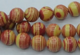 CTU287 16 inches 10mm round imitation turquoise beads wholesale
